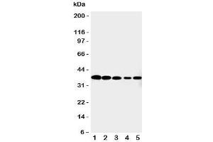Western blot testing of Cdk7 antibody and Lane 1:  HeLa;  2: MCF-7;  3: A549;  4: COLO320;  5: Jurkat cell lysate.
