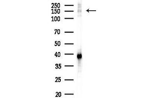 Western blot analysis of lysates from EC304 cells(heat-shock,45 min treatment), using NF Antibody at 1/1000 dilution.