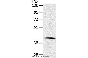Western blot analysis of Human lymphoma tissue, using CDK10 Polyclonal Antibody at dilution of 1:100 (CDK10 anticorps)
