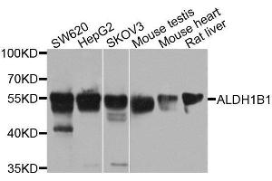 Western blot analysis of extracts of various cell lines, using ALDH1B1 antibody. (ALDH1B1 anticorps  (AA 278-517))