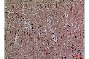 Immunohistochemistry (IHC) analysis of paraffin-embedded Human Brain, antibody was diluted at 1:100.