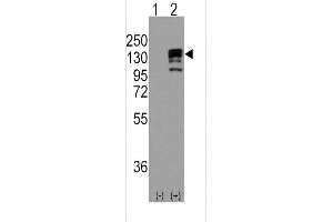 Western blot analysis of CDH1 using rabbit polyclonal CDH1 Antibody.