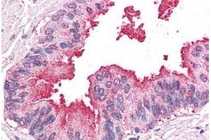 Human Prostate: Formalin-Fixed, Paraffin-Embedded (FFPE)