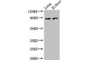 Western Blot Positive WB detected in: Mouse lung tissue, Mouse kidney tissue All lanes: NAALADL2 antibody at 3. (NAALADL2 anticorps  (AA 143-795))