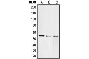 Western blot analysis of RAP1A expression in HEK293T (A), HeLa (B), PC12 (C) whole cell lysates.