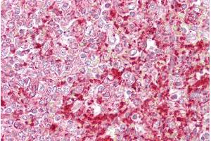 Immunohistochemistry with Spleen tissue at an antibody concentration of 5µg/ml using anti-ETV5 antibody (ARP31658_P050) (ETV5 anticorps  (N-Term))
