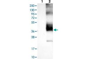 Western blot analysis of Lane 1: Negative control (vector only transfected HEK293T lysate), Lane 2: Over-expression Lysate (Co-expressed with a C-terminal myc-DDK tag (~3. (KCNK1 anticorps)