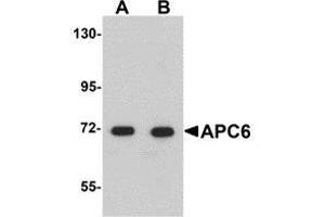 Western blot analysis of APC6 in human liver tissue lysate with AP30062PU-N APC6 antibody at (A) 1 and (B) 2 μg/ml. (CDC16 anticorps  (N-Term))