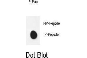Dot blot analysis of anti-mPDHE1A- Phospho-specific Pab ABIN650896 on nitrocellulose membrane. (Pyruvate Dehydrogenase E1 alpha (pSer232) anticorps)