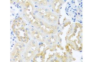 Immunohistochemistry of paraffin-embedded Rat kidney using TDGF1 Polyclonal Antibody at dilution of 1:100 (40x lens).