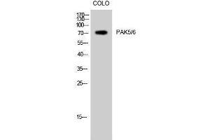 Western Blotting (WB) image for anti-PAK5/6 (Ser1197) antibody (ABIN3180792) (PAK5/6 (Ser1197) anticorps)
