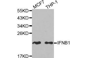 Western blot analysis of extracts of MCF7 and THP-1 cell lines, using IFNB1 antibody. (IFNB1 anticorps)