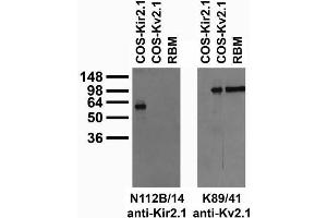 Adult rat brain membrane (RBM) and transfected cell immunoblot: extracts of RBM and COS cells transiently transfected with HA-tagged Kir2.