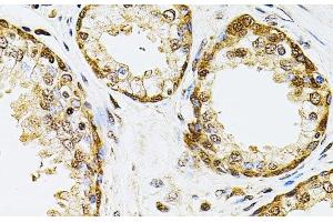 Immunohistochemistry of paraffin-embedded Human prostate using POP4 Polyclonal Antibody at dilution of 1:100 (40x lens). (RPP29 anticorps)