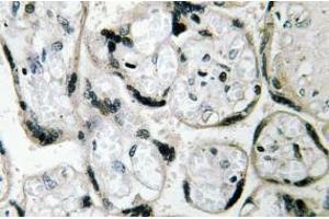 Image no. 1 for anti-Cytochrome B5 Reductase 3 (CYB5R3) antibody (ABIN317921) (CYB5R3 anticorps)