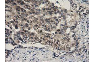 Image no. 9 for anti-Sepiapterin Reductase (SPR) antibody (ABIN1501111)