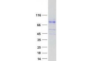 Validation with Western Blot