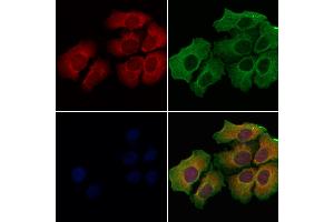 ABIN6259828 and ABIN6278001 staining Hela cells by IF/ICC. (AGR2 anticorps  (N-Term))