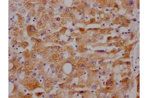 IHC image of ABIN7127448 diluted at 1:100 and staining in paraffin-embedded human liver tissue performed on a Leica BondTM system.