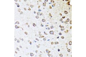 Immunohistochemistry of paraffin-embedded mouse brain using SERPINA10 antibody. (SERPINA10 anticorps  (AA 165-444))