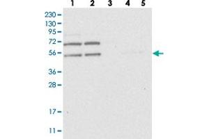 Western blot analysis of Lane 1: RT-4, Lane 2: U-251 MG, Lane 3: Human Plasma, Lane 4: Liver, Lane 5: Tonsil with C2orf30 polyclonal antibody . (C2orf30 anticorps)