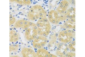 Immunohistochemistry of paraffin-embedded Mouse kidney using C1GALT1 Polyclonal Antibody at dilution of 1:100 (40x lens). (C1GALT1 anticorps)