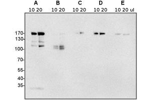 Western Blotting (WB) image for anti-Clathrin Heavy Chain (CLTC) antibody (ABIN7477856) (Clathrin Heavy Chain (CLTC) anticorps)