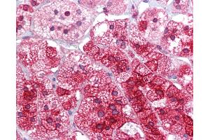 Anti-ARC antibody IHC of human adrenal.