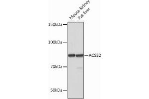 Western blot analysis of extracts of various cell lines, using  Rabbit mAb (ABIN7265427) at 1:1000 dilution.