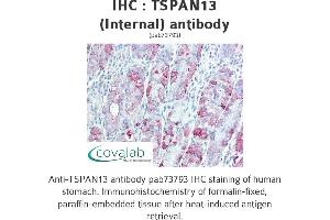 Image no. 2 for anti-Tetraspanin 13 (TSPAN13) (Internal Region) antibody (ABIN1740425)