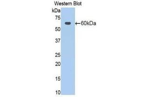 Western Blotting (WB) image for anti-Activated Leukocyte Cell Adhesion Molecule (ALCAM) (AA 28-527) antibody (ABIN1077751) (CD166 anticorps  (AA 28-527))