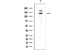 anti-Homeodomain Interacting Protein Kinase 2 (HIPK2) (N-Term) antibody