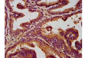 IHC image of ABIN7171980 diluted at 1:300 and staining in paraffin-embedded human prostate tissue performed on a Leica BondTM system.
