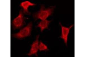 ABIN6276156 staining HeLa by IF/ICC. (OR4F6 anticorps  (Internal Region))