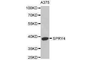 Western Blotting (WB) image for anti-Sprouty RTK Signaling Antagonist 4 (SPRY4) antibody (ABIN1980279) (SPRY4 anticorps)