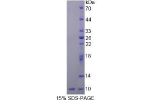 SDS-PAGE analysis of Rat Insulin Like Growth Factor 2 (IGF2) Protein. (IGF2 Protéine)