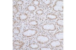 Immunohistochemistry (IHC) image for anti-ElaC Homolog 2 (ELAC2) (AA 150-200) antibody (ABIN7455053) (ELAC2 anticorps  (AA 150-200))