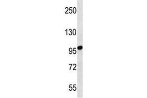 STIM2 antibody western blot analysis in uterus tumor lysate.