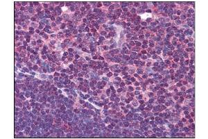 Human Thymus: Formalin-Fixed, Paraffin-Embedded (FFPE)