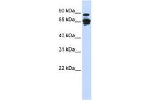 Image no. 1 for anti-Amphiphysin (AMPH) (N-Term) antibody (ABIN6743835) (Amphiphysin anticorps  (N-Term))