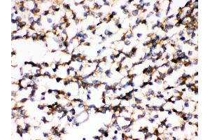 Anti- KCNIP2 Picoband antibody,IHC(P) IHC(P): Human Glioma Tissue