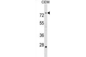 Western Blotting (WB) image for anti-Actin Binding LIM Protein Family, Member 3 (ABLIM3) antibody (ABIN2999456) (ABLIM3 anticorps)