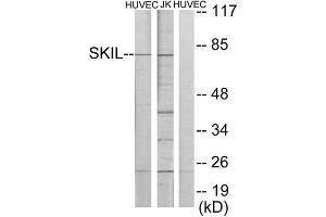 Western Blotting (WB) image for anti-SKI-Like Oncogene (SKIL) (C-Term) antibody (ABIN1849158) (SKIL anticorps  (C-Term))