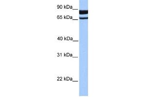 WB Suggested Anti-PDE1C Antibody Titration: 0. (PDE1C anticorps  (N-Term))
