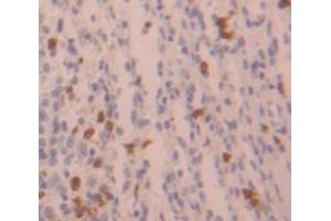 Figure. (HIST2H3A anticorps  (AA 1-136))