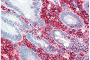 Human Small Intestine (formalin-fixed, paraffin-embedded) stained with CD44 antibody ABIN396970 at 5 ug/ml followed by biotinylated anti-mouse IgG secondary antibody ABIN481714, alkaline phosphatase-streptavidin and chromogen.