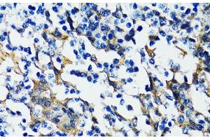 Immunohistochemistry of paraffin-embedded Human tonsil using HDAC5 Polyclonal Antibody at dilution of 1:100 (40x lens).
