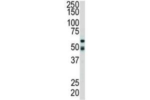 Western blot analysis of RIPK2 antibody and mouse cerebellum tissue lysate.
