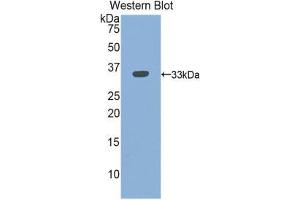 Western Blotting (WB) image for anti-Integrin beta 3 (ITGB3) (AA 134-376) antibody (ABIN1859506) (Integrin beta 3 anticorps  (AA 134-376))