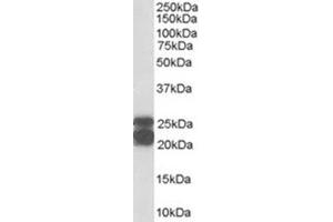Image no. 2 for anti-Caveolin 1, Caveolae Protein, 22kDa (CAV1) (Internal Region) antibody (ABIN374578) (Caveolin-1 anticorps  (Internal Region))